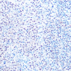 Small Nuclear Ribonucleoprotein Polypeptides B And B1 (SNRPB) Antibody