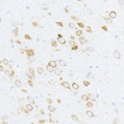 RPS6 (pS240 / 244) Antibody