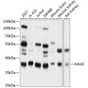 Western blot analysis of various lysates using NAGK Antibody at 1/1000 dilution. Secondary antibody: HRP-conjugated Goat anti-Rabbit IgG (H+L) at 1/10000 dilution. Lysates/proteins: 25 µg per lane. Blocking buffer: 3% nonfat dry milk in TBST. Exposure time: 5s.