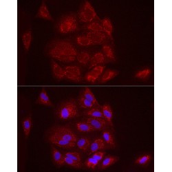 Fc Fragment Of IgG Receptor Transporter Alpha (FCGRT) Antibody