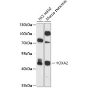 Western blot analysis of various lysates using HOXA2 Antibody at 1/1000 dilution. Secondary antibody: HRP-conjugated Goat anti-Rabbit IgG (H+L) at 1/10000 dilution. Lysates/proteins: 25 µg per lane. Blocking buffer: 3% nonfat dry milk in TBST. Exposure time: 30s.