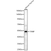 Western blot analysis of lysates from Mouse thymus, using TXNIP Antibody at 1/2000 dilution. Secondary antibody: HRP-conjugated Goat anti-Rabbit IgG (H+L) at 1/10000 dilution. Lysates/proteins: 25 µg per lane. Blocking buffer: 3% nonfat dry milk in TBST. Exposure time: 60s.