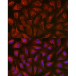 Thioredoxin-Interacting Protein (TXNIP) Antibody