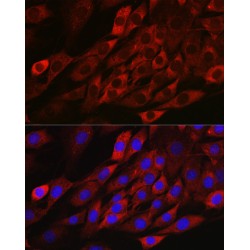 Thioredoxin-Interacting Protein (TXNIP) Antibody