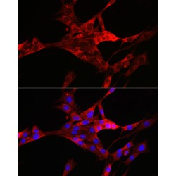 Thioredoxin-Interacting Protein (TXNIP) Antibody