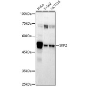 Western blot analysis of various lysates using SKP2 Antibody at 1/500 dilution. Secondary antibody: HRP-conjugated Goat anti-Rabbit IgG (H+L) at 1/10000 dilution. Lysates/proteins: 25 µg per lane. Blocking buffer: 3% nonfat dry milk in TBST. Exposure time: 180s.