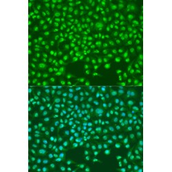 S-Phase Kinase-Associated Protein 2 (SKP2) Antibody