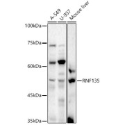 Western blot analysis of various lysates using RNF135 Antibody at 1/500 dilution. Secondary antibody: HRP-conjugated Goat anti-Rabbit IgG (H+L) at 1/10000 dilution. Lysates/proteins: 25 µg per lane. Blocking buffer: 3% nonfat dry milk in TBST. Exposure time: 30s.