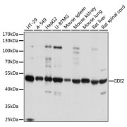 Western blot analysis of various lysates using [KO Validated] GDI2 Antibody at 1/1000 dilution. Secondary antibody: HRP-conjugated Goat anti-Rabbit IgG (H+L) at 1/10000 dilution. Lysates/proteins: 25 µg per lane. Blocking buffer: 3% nonfat dry milk in TBST. Exposure time: 1s.