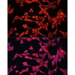 GDP Dissociation Inhibitor 2 (GDI2) Antibody