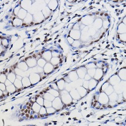 Methyltransferase-Like Protein 14 (METTL14) Antibody