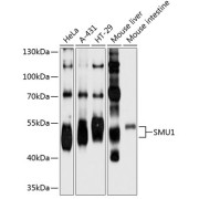 Western blot analysis of various lysates using SMU1 Antibody at 1/1000 dilution. Secondary antibody: HRP-conjugated Goat anti-Rabbit IgG (H+L) at 1/10000 dilution. Lysates/proteins: 25 µg per lane. Blocking buffer: 3% nonfat dry milk in TBST. Exposure time: 10s.