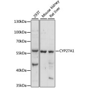 Western blot analysis of various lysates using CYP27A1 Antibody at 1/1000 dilution. Secondary antibody: HRP-conjugated Goat anti-Rabbit IgG (H+L) at 1/10000 dilution. Lysates/proteins: 25 µg per lane. Blocking buffer: 3% nonfat dry milk in TBST. Exposure time: 10s.