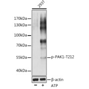 Western blot analysis of various lysates using Phospho-PAK1-T212 antibody at 1/1000 dilution. 293T cells were treated by ATP(5 mM) at 30 °C for 1 hour. Secondary antibody: HRP-conjugated Goat anti-Rabbit IgG (H+L) at 1/10000 dilution. Lysates/proteins: 25 µg per lane. Blocking buffer: 3% nonfat dry milk in TBST. Exposure time: 1s.