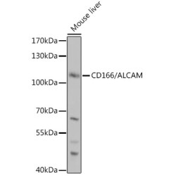 Activated Leukocyte Cell Adhesion Molecule / CD166 (ALCAM) Antibody