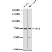 Western blot analysis of various lysates using PLK3 Antibody at 1/1000 dilution. Secondary antibody: HRP-conjugated Goat anti-Rabbit IgG (H+L) at 1/10000 dilution. Lysates/proteins: 25 µg per lane. Blocking buffer: 3% nonfat dry milk in TBST. Exposure time: 180s.