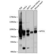 Western blot analysis of various lysates using MTO1 Antibody at 1/1000 dilution. Secondary antibody: HRP-conjugated Goat anti-Rabbit IgG (H+L) at 1/10000 dilution. Lysates/proteins: 25 µg per lane. Blocking buffer: 3% nonfat dry milk in TBST. Exposure time: 1s.