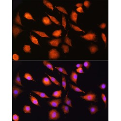 Exostosin 2 (EXT2) Antibody