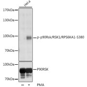 Western blot analysis of various lysates using Phospho-p90Rsk/RSK1/RPS6KA1-S380 Antibody at 1/1000 dilution or RPS6KA1 antibody. HeLa cells were treated by PMA/TPA (200 nM) at 37 °C for 15 minutes after serum-starvation overnight. Secondary antibody: HRP-conjugated Goat anti-Rabbit IgG (H+L) at 1/10000 dilution. Lysates/proteins: 25 µg per lane. Blocking buffer: 3% BSA. Exposure time: 1s.