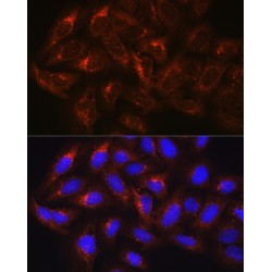 Hepatocyte Growth Factor-Regulated Tyrosine Kinase Substrate (HGS) Antibody