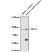 Western blot analysis of various lysates using TRPV3 Antibody at 1/1000 dilution. Secondary antibody: HRP-conjugated Goat anti-Rabbit IgG (H+L) at 1/10000 dilution. Lysates/proteins: 25 µg per lane. Blocking buffer: 3% nonfat dry milk in TBST. Exposure time: 60s.