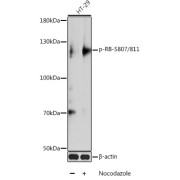 Western blot analysis of lysates from HT-29 cells, using Phospho-RB-S807/811 Antibody at 1/1000 dilution. HT-29 cells were treated by Nocodazole (100ng/ml) for 16 hours. Secondary antibody: HRP-conjugated Goat anti-Rabbit IgG (H+L) at 1/10000 dilution. Lysates/proteins: 25 µg per lane. Blocking buffer: 3% BSA. Exposure time: 5s.