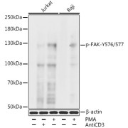 Western blot analysis of various lysates, using Phospho-FAK-Y576/577 Antibody at 1/1000 dilution. Jurkat cells were treated by CD-3 (10 µg/ml) for 2 minutes after serum-starvation overnight or treated by PMA/TPA (200nM) for 10 minutes. Raji cells were treated by PMA/TPA (200nM) for 30 minutes. Secondary antibody: HRP-conjugated Goat anti-Rabbit IgG (H+L) at 1/10000 dilution. Lysates/proteins: 25 µg per lane. Blocking buffer: 3% BSA. Exposure time: 90s.