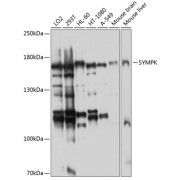 Western blot analysis of various lysates using SYMPK Antibody at 1/1000 dilution. Secondary antibody: HRP-conjugated Goat anti-Rabbit IgG (H+L) at 1/10000 dilution. Lysates/proteins: 25 µg per lane. Blocking buffer: 3% nonfat dry milk in TBST. Exposure time: 30s.