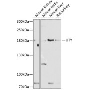 Western blot analysis of various lysates using UTY Antibody at 1/1000 dilution. Secondary antibody: HRP-conjugated Goat anti-Rabbit IgG (H+L) at 1/10000 dilution. Lysates/proteins: 25 µg per lane. Blocking buffer: 3% nonfat dry milk in TBST. Exposure time: 60s.