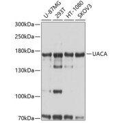 Western blot analysis of various lysates using UACA Antibody at 1/1000 dilution. Secondary antibody: HRP-conjugated Goat anti-Rabbit IgG (H+L) at 1/10000 dilution. Lysates/proteins: 25 µg per lane. Blocking buffer: 3% nonfat dry milk in TBST. Exposure time: 5s.