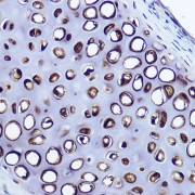 Immunohistochemistry analysis of paraffin-embedded Mouse cartilage using Aggrecan Antibody at dilution of 1/50 (40x lens). High pressure antigen retrieval performed in 0.01 M Citrate buffer (pH 6.0) prior to IHC staining.