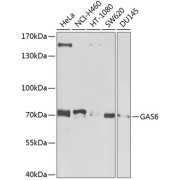 Western blot analysis of various lysates using GAS6 Antibody at 1/1000 dilution. Secondary antibody: HRP-conjugated Goat anti-Rabbit IgG (H+L) at 1/10000 dilution. Lysates/proteins: 25 µg per lane. Blocking buffer: 3% nonfat dry milk in TBST. Exposure time: 30s.