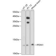 Western blot analysis of various lysates using PFDN1 Antibody at 1/3000 dilution. Secondary antibody: HRP-conjugated Goat anti-Rabbit IgG (H+L) at 1/10000 dilution. Lysates/proteins: 25 µg per lane. Blocking buffer: 3% nonfat dry milk in TBST. Exposure time: 30s.