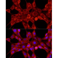 Mitochondrial Import Inner Membrane Translocase Subunit Tim23 (TIMM23) Antibody