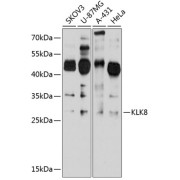 Western blot analysis of various lysates using KLK8 Antibody at 1/1000 dilution. Secondary antibody: HRP-conjugated Goat anti-Rabbit IgG (H+L) at 1/10000 dilution. Lysates/proteins: 25 µg per lane. Blocking buffer: 3% nonfat dry milk in TBST. Exposure time: 20s.