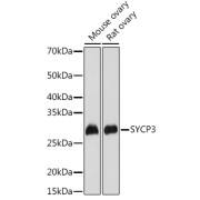 Western blot analysis of various lysates using SYCP3 Antibody at 1/1000 dilution. Secondary antibody: HRP-conjugated Goat anti-Rabbit IgG (H+L) at 1/10000 dilution. Lysates/proteins: 25 µg per lane. Blocking buffer: 3% nonfat dry milk in TBST. Exposure time: 30s.