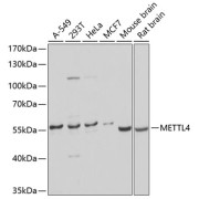 Western blot analysis of various lysates using METTL4 Antibody at 1/2000 dilution. Secondary antibody: HRP-conjugated Goat anti-Rabbit IgG (H+L) at 1/10000 dilution. Lysates/proteins: 25 µg per lane. Blocking buffer: 3% nonfat dry milk in TBST. Exposure time: 1s.