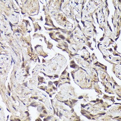 Methyltransferase Like Protein 4 (METTL4) Antibody