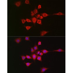 Methyltransferase Like Protein 4 (METTL4) Antibody