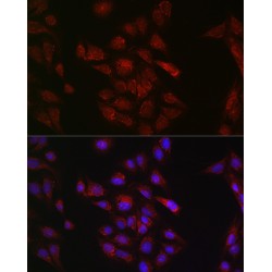 Methyltransferase Like Protein 4 (METTL4) Antibody