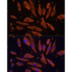 Signal Regulatory Protein Alpha (SIRPA) Antibody