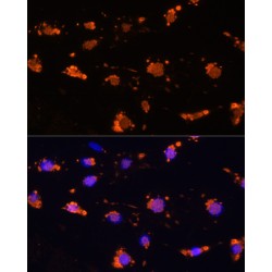 Signal Regulatory Protein Alpha (SIRPA) Antibody