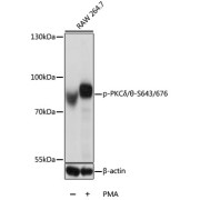 Western blot analysis of lysates from RAW264.7 cells, using Phospho-PKCδ/θ-S643/676 Antibody at 1/1000 dilution. RAW 264.7 cells were treated by PMA (200 nM) for 30 minutes . Secondary antibody: HRP-conjugated Goat anti-Rabbit IgG (H+L) at 1/10000 dilution. Lysates/proteins: 25 µg per lane. Blocking buffer: 3% BSA. Exposure time: 5s.