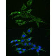 Immunofluorescence analysis of PC-12 cells using Vimentin Rabbit antibody at a dilution of 1/100 (40x lens). Secondary antibody: FITC Donkey Anti-Rabbit IgG (H+L) at dilution of 1/200 (40x lens). Blue: DAPI for nuclear staining.