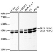 Western blot analysis of various lysates, using ERK1 / ERK2 Mouse antibody at 1/500 dilution. Secondary antibody: HRP-conjugated Goat anti-Mouse IgG (H+L) at 1/10000 dilution. Lysates/proteins: 25 µg per lane. Blocking buffer: 3% nonfat dry milk in TBST. Exposure time: 20s.