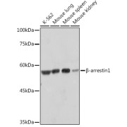 Western blot analysis of various lysates using β-arrestin1 Rabbit antibody at 1/1000 dilution. Secondary antibody: HRP-conjugated Goat anti-Rabbit IgG (H+L) at 1/10000 dilution. Lysates/proteins: 25 µg per lane. Blocking buffer: 3% nonfat dry milk in TBST. Exposure time: 3s.