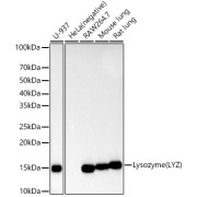 Western blot analysis of various lysates using Lysozyme (LYZ) Rabbit antibodyat 1/60000 dilution incubated overnight at 4 °C. Secondary antibody: HRP-conjugated Goat anti-Rabbit IgG (H+L) at 1/10000 dilution. Lysates/proteins: 25 µg per lane. Blocking buffer: 3% nonfat dry milk in TBST. Negative control (NC): HeLa Exposure time: 60s.