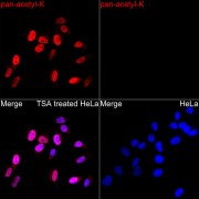 Immunofluorescence analysis of HeLa TSA and HeLa cells using Pan Acetyl-Lysine Antibody at dilution of 1/50 (40x lens). Secondary antibody: Cy3-conjugated Goat anti-Rabbit IgG (H+L) at 1/500 dilution. Blue: DAPI for nuclear staining.