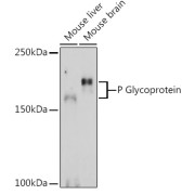 Western blot analysis of various lysates using P Glycoprotein Antibody at 1/1000 dilution. Secondary antibody: HRP-conjugated Goat anti-Rabbit IgG (H+L) at 1/10000 dilution. Lysates/proteins: 25 µg per lane. Blocking buffer: 3% nonfat dry milk in TBST. Exposure time: 180s.