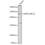 Western blot analysis of lysates from HepG2 cells, using MRP1/ABCC1 Antibody at 1/1000 dilution. Secondary antibody: HRP-conjugated Goat anti-Rabbit IgG (H+L) at 1/10000 dilution. Lysates/proteins: 25 µg per lane. Blocking buffer: 3% nonfat dry milk in TBST. Exposure time: 5s.